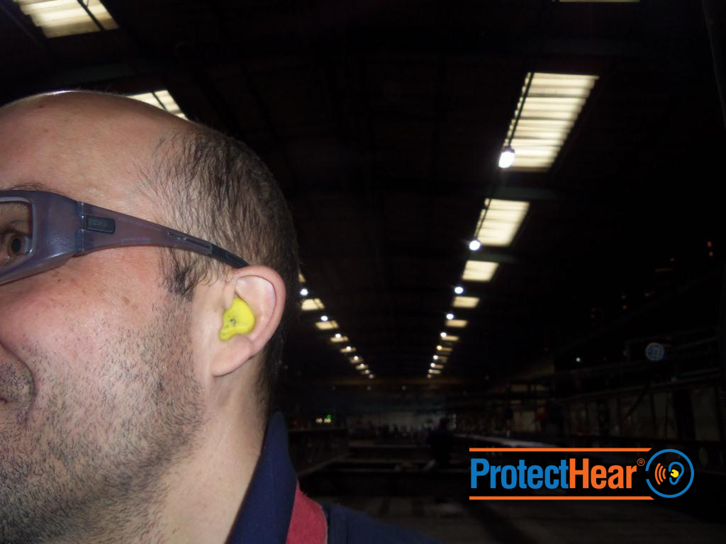 Custom made ear plugs being used in William Hare