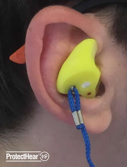 fitting custom earplugs
