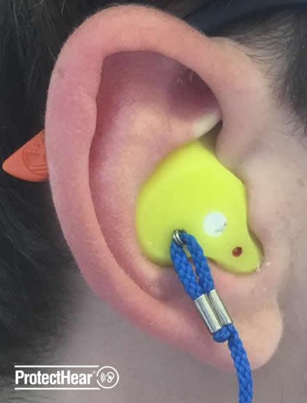 custom earplug fit